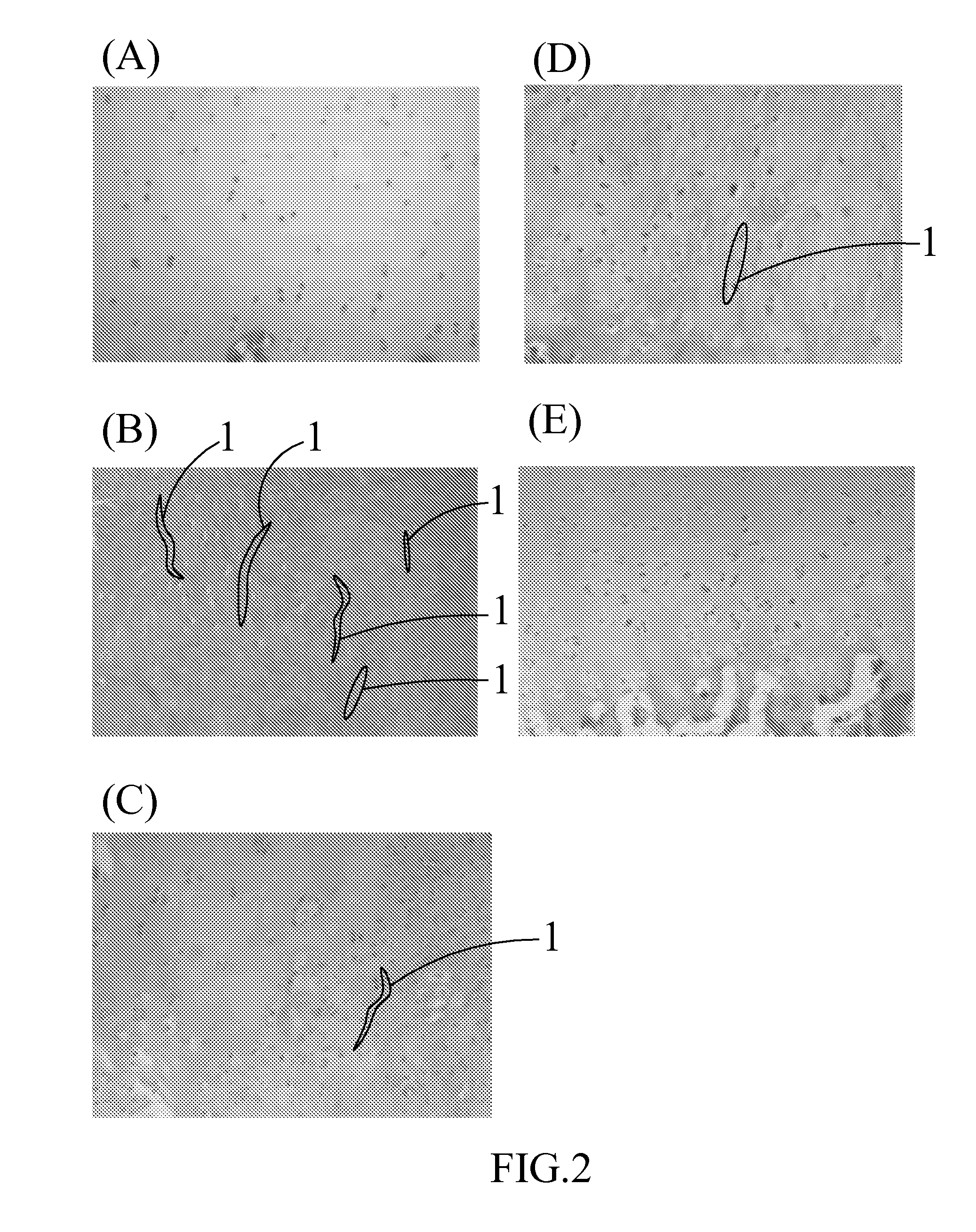 Composition for treating articular cartilage defect, and method of manufacture thereof