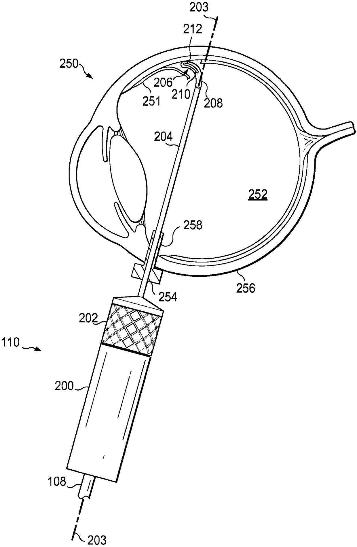 Subretinal fluid drainage instruments, systems, and methods