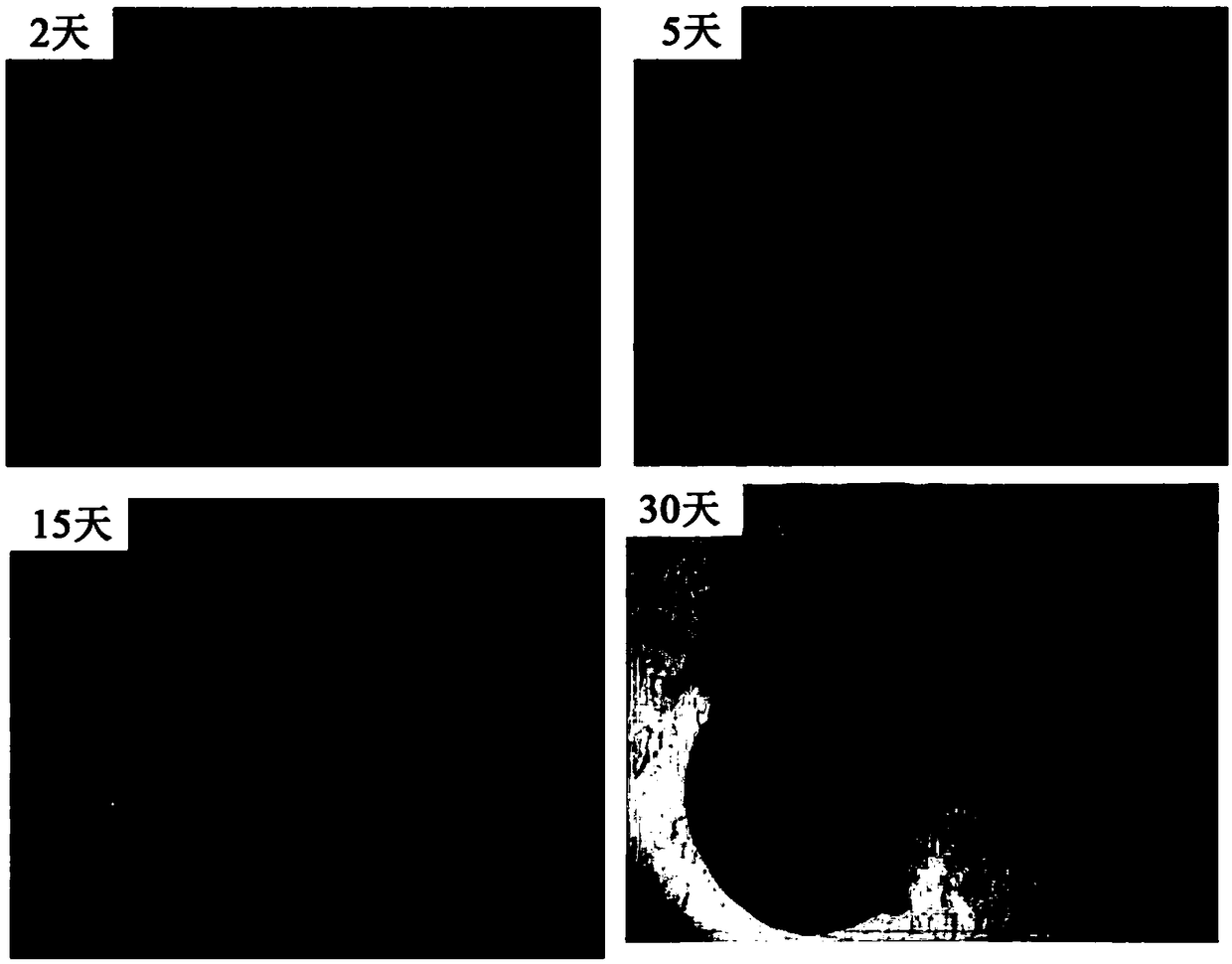 Application of humanized brain-like organ to brain injury dyskinesia disease