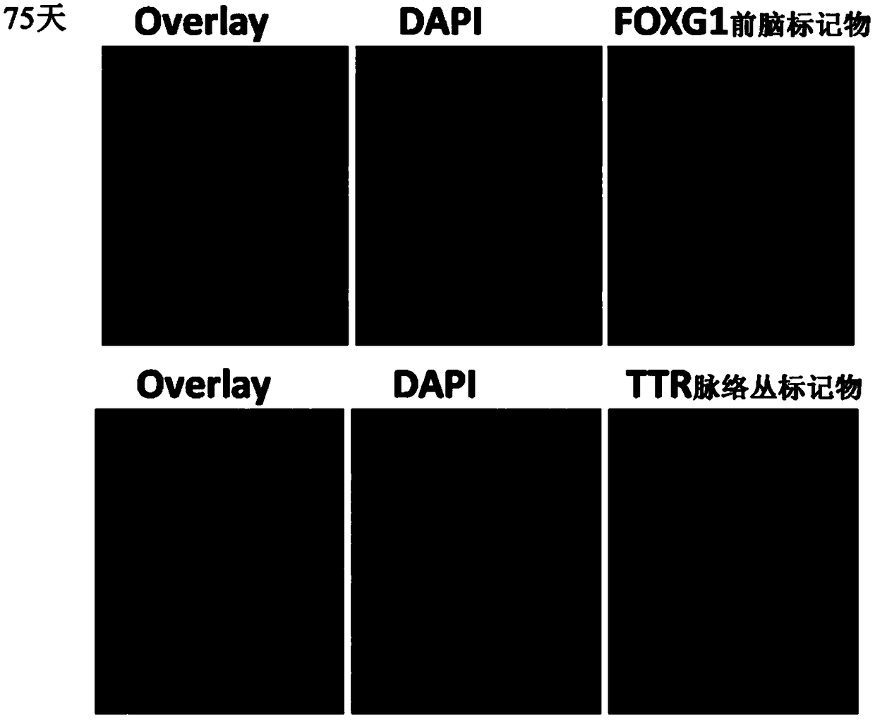 Application of humanized brain-like organ to brain injury dyskinesia disease