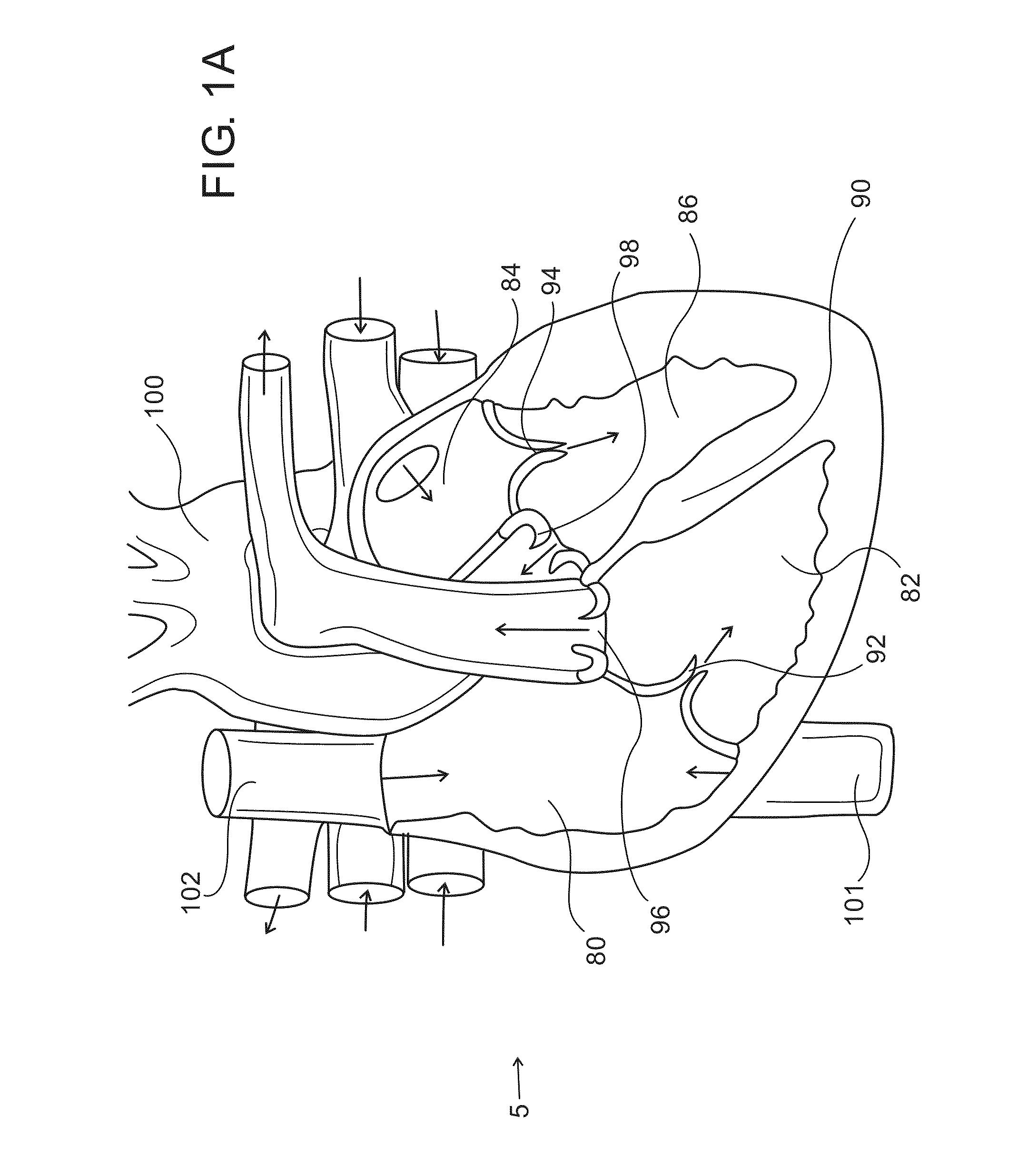 Methods and implantable devices for treating supraventricular arrhythmias