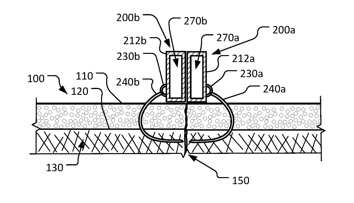 Magnetic wound closure systems