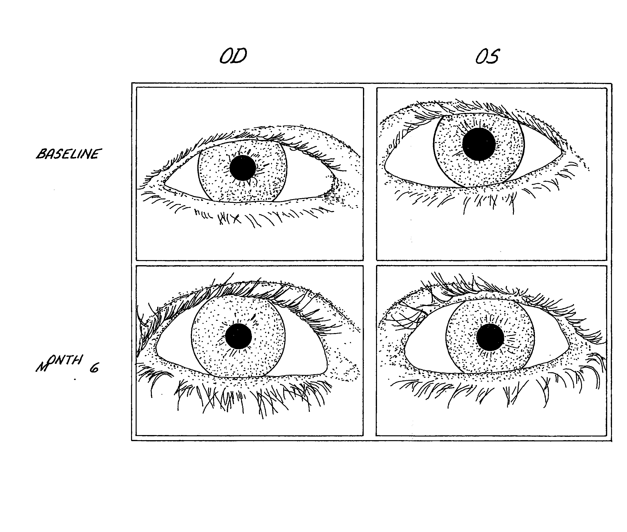 Method of Enhancing Hair Growth