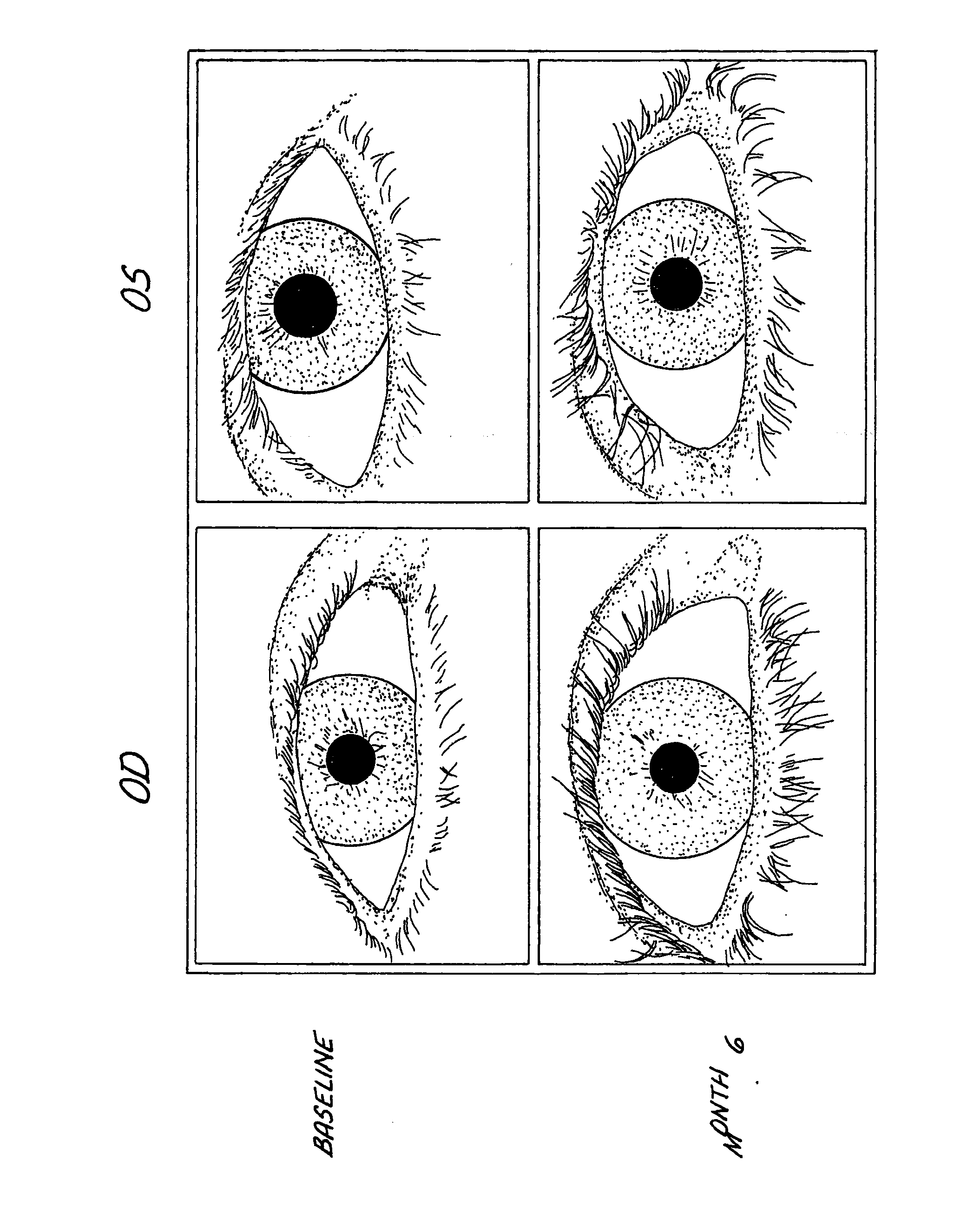 Method of Enhancing Hair Growth