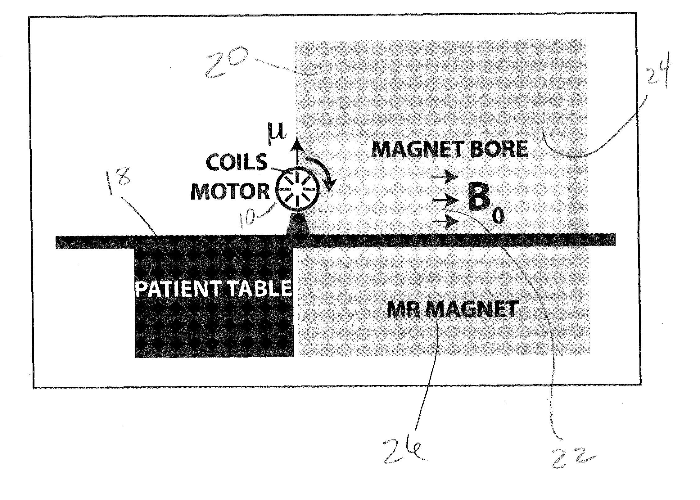 RF coil for use in magnetic resonance imaging in integrated spect and mr imaging