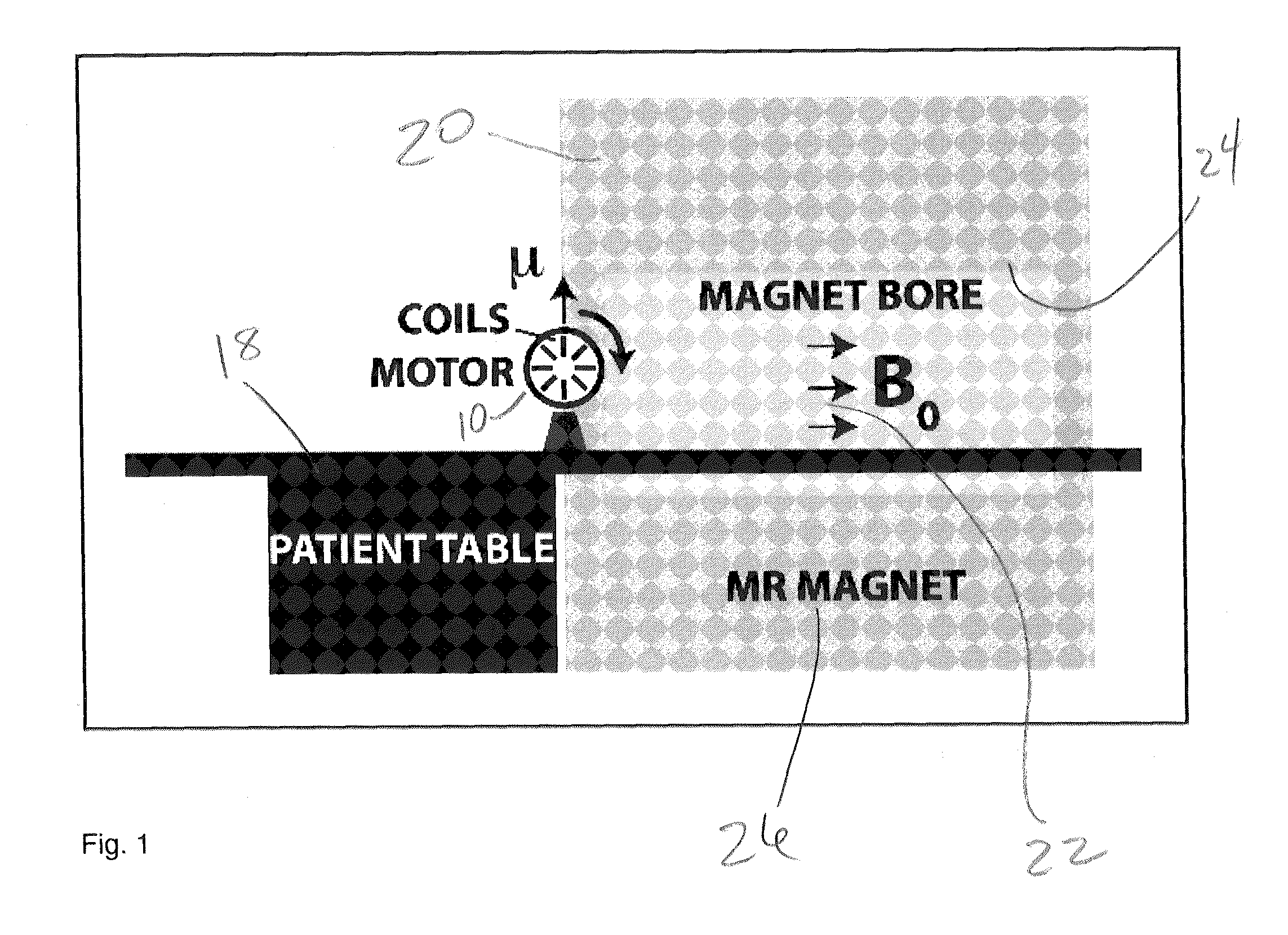 RF coil for use in magnetic resonance imaging in integrated spect and mr imaging