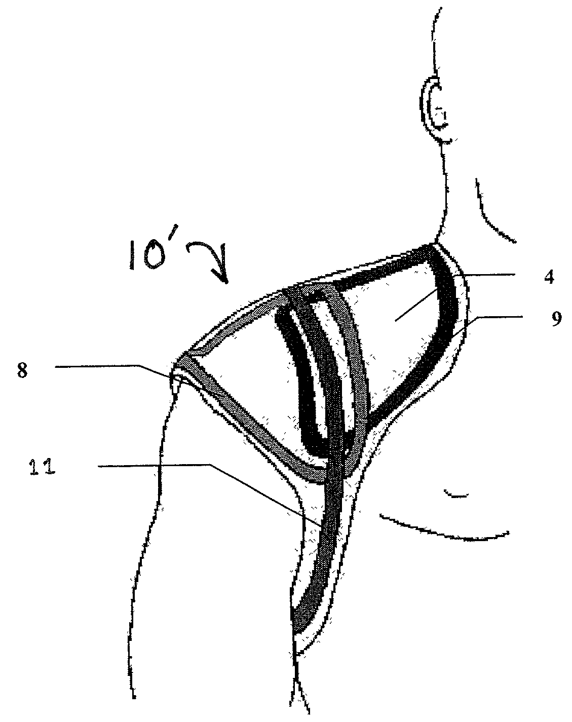 MRI shoulder coil