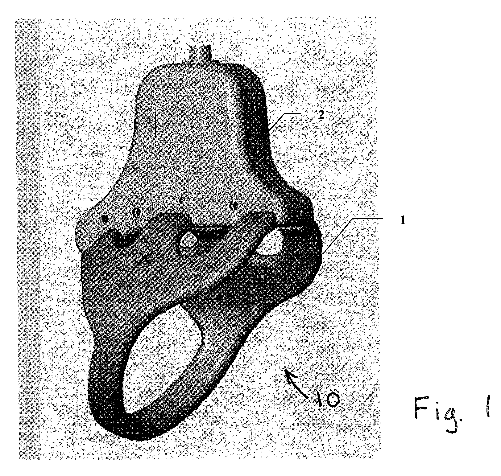 MRI shoulder coil