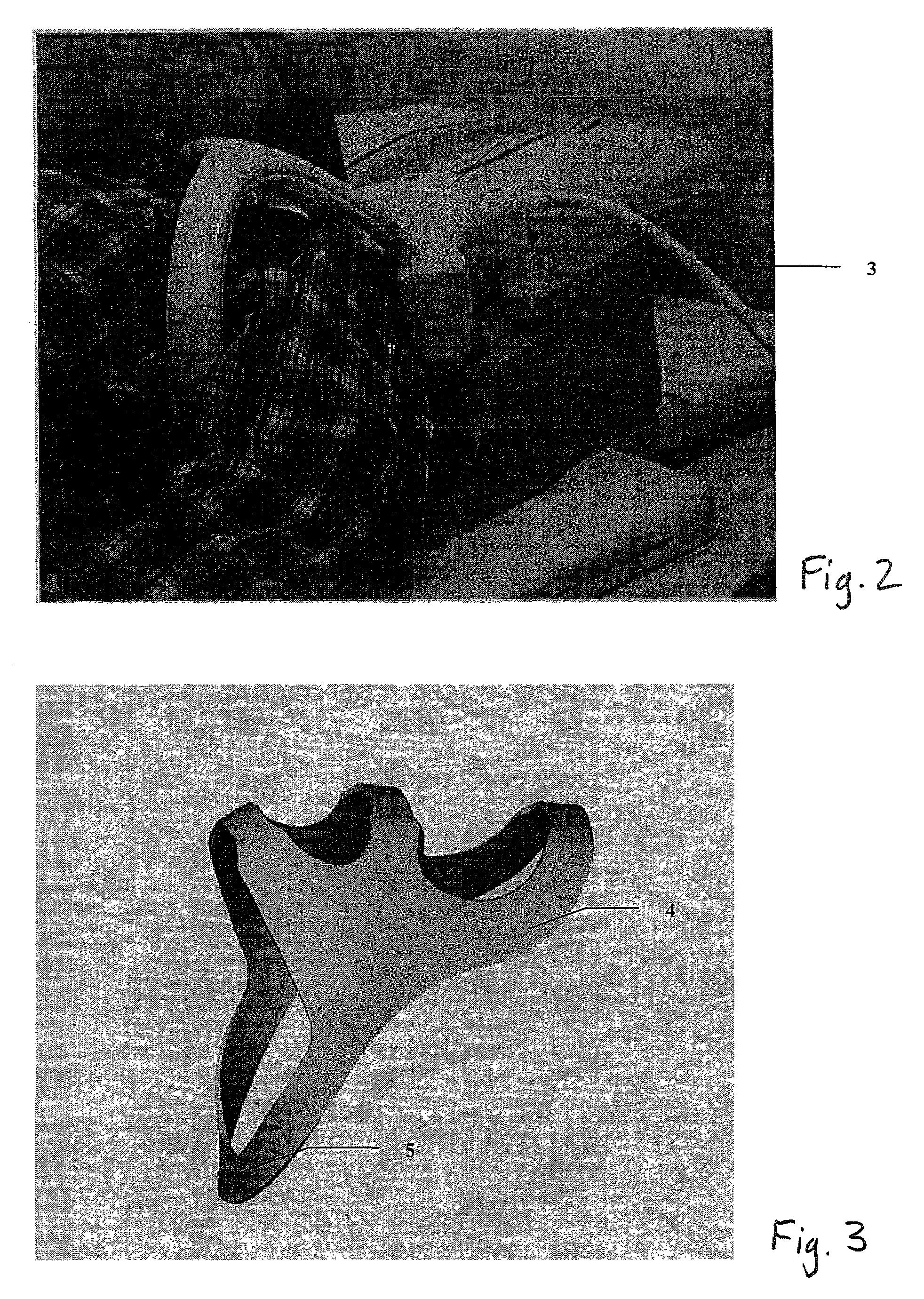 MRI shoulder coil