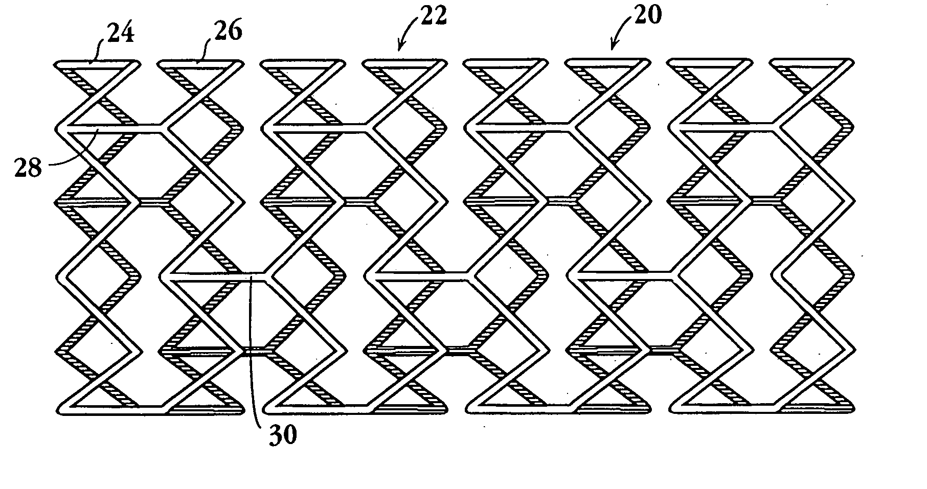 Drug-delivery endovascular stent and method of forming the same