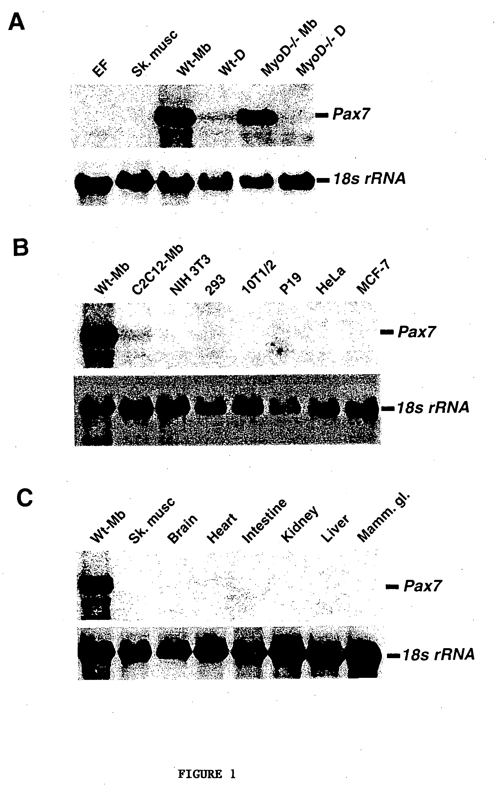 Pax-encoding vector and use thereof