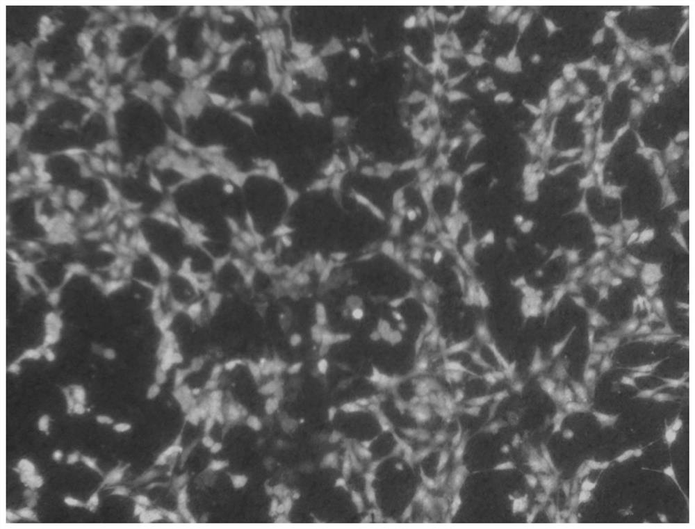 Preparation and Application of a Biocompatibility Coating for Improving the Surface of Medical Zinc/Zinc Alloy