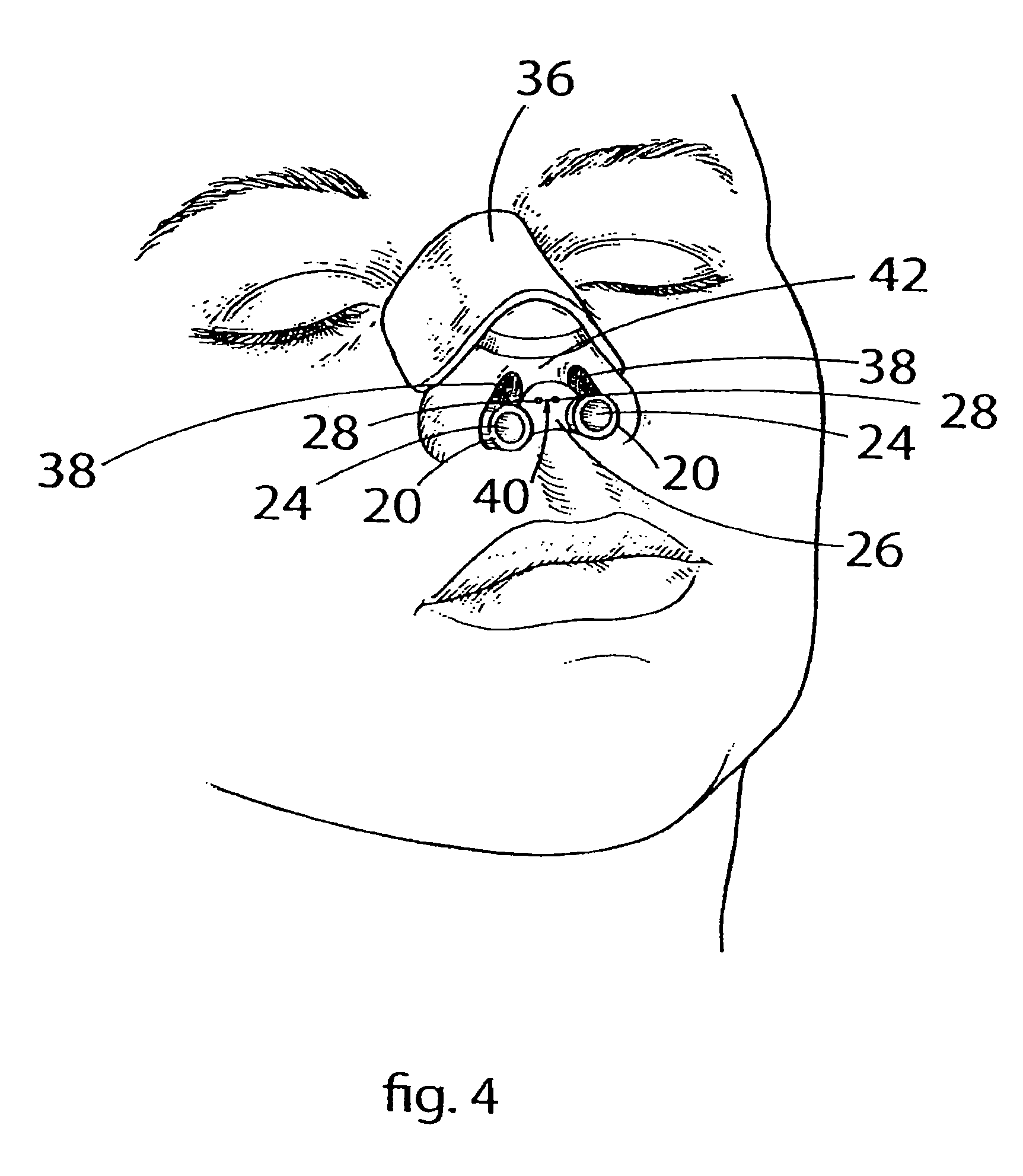 Device and Method for Maintaining Unobstructed Nasal Passageways after Nasal Surgery