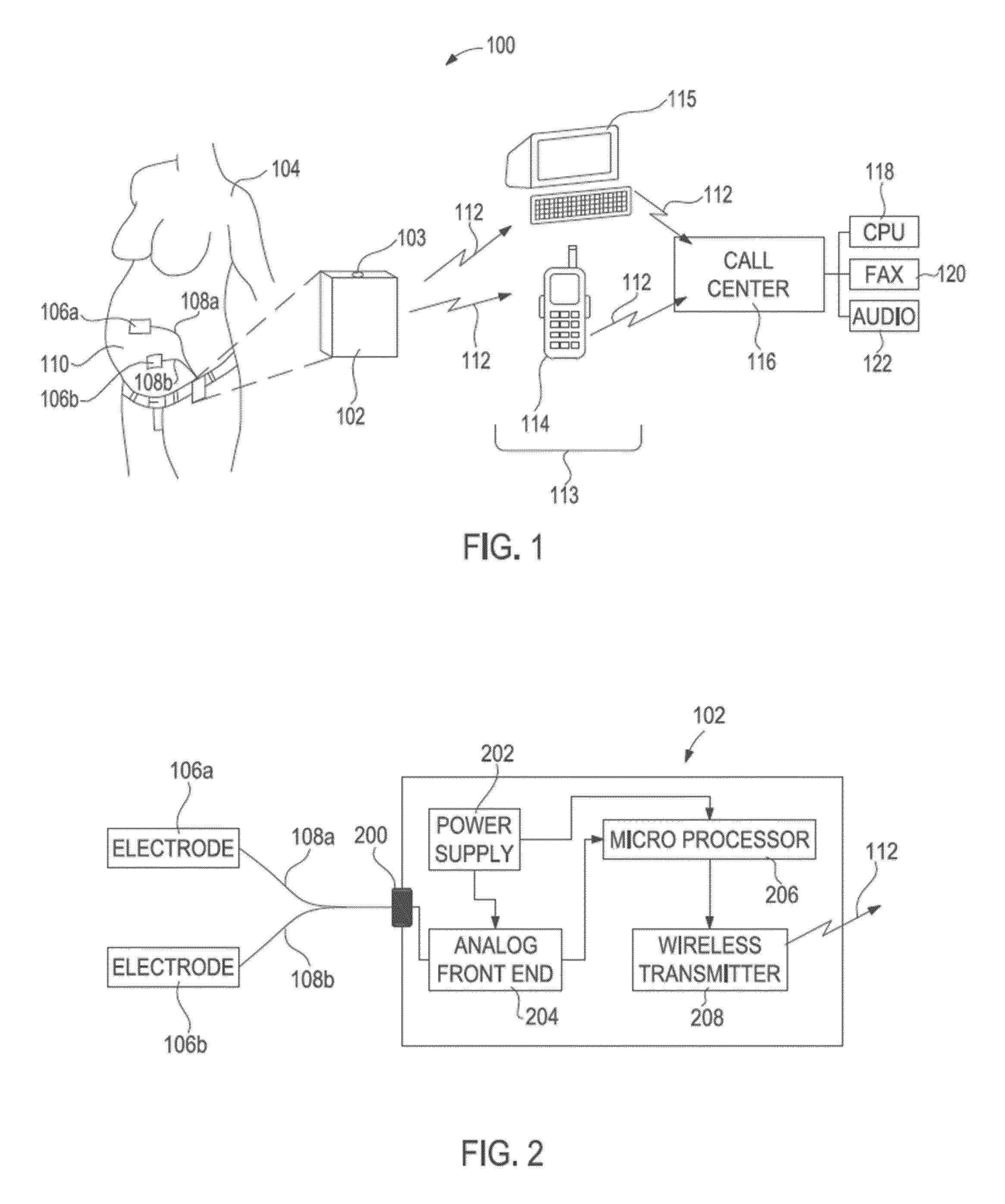 Method and system to monitor, detect, diagnose and predict the separation/rupture of the uterine scar associated with vaginal birth after cesarean procedures