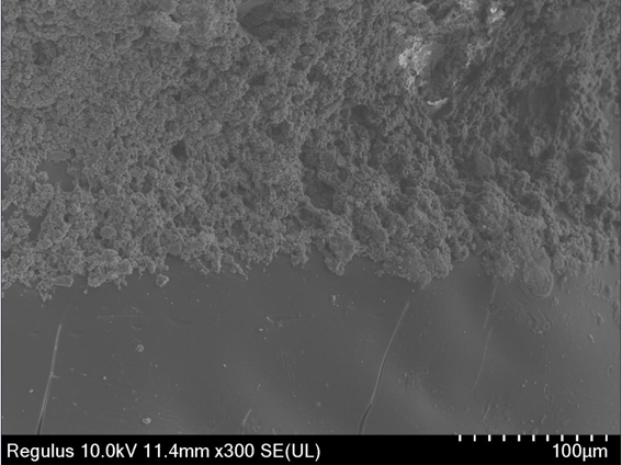 Preparation, product and application of sandwich type degradable stent for alveolar bone repair