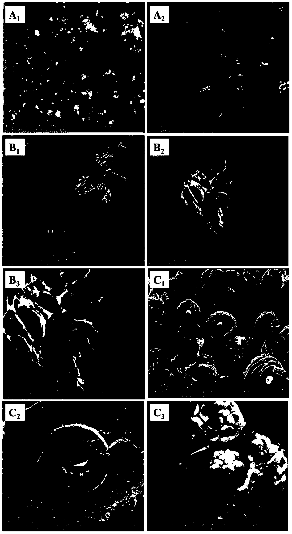 Preparation method of silibinin nano-cage type nanocrystalline injection