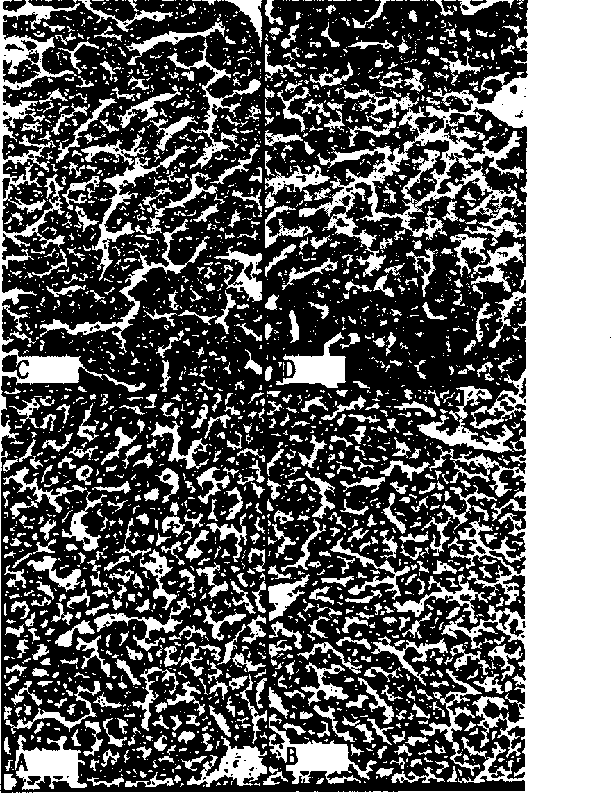 Pharmaceutical composition comprising pyrroloquinoline quinone for curing and preventing fatty liver