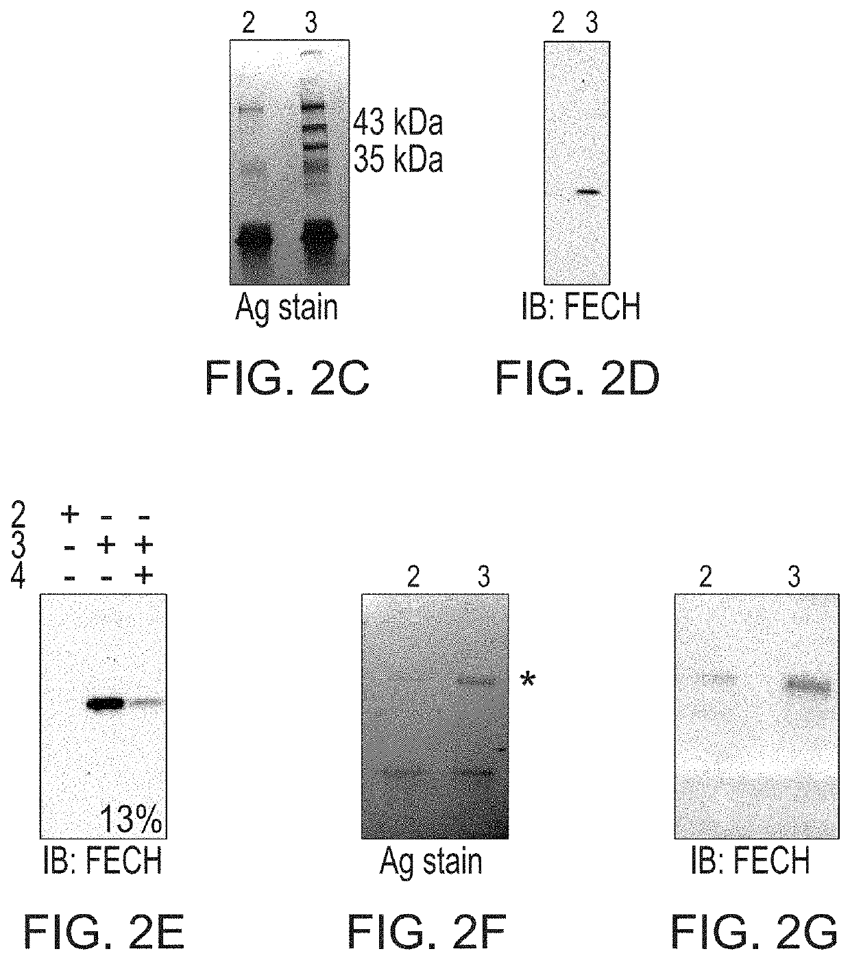 Inhibition of ferrochelatase as an antiangiogenic therapy