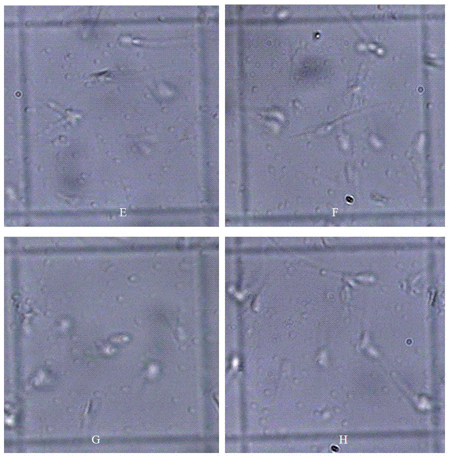 Method for detecting number of effective sperms in porcine seminal plasma