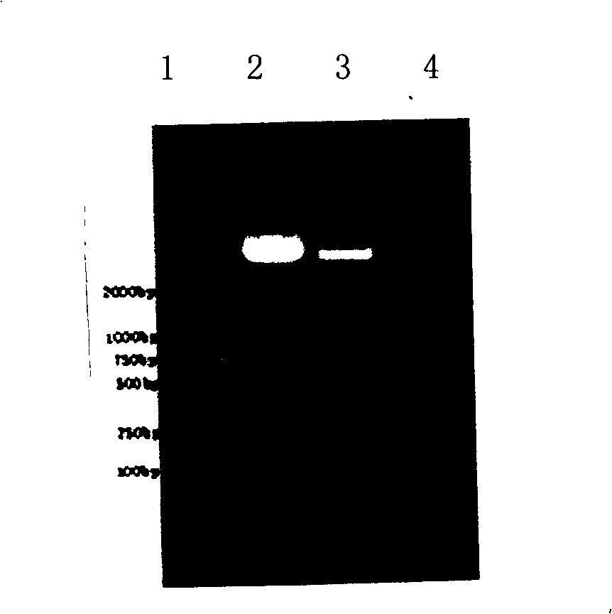 High activity, low antigen glucokinase derivant and preparation method