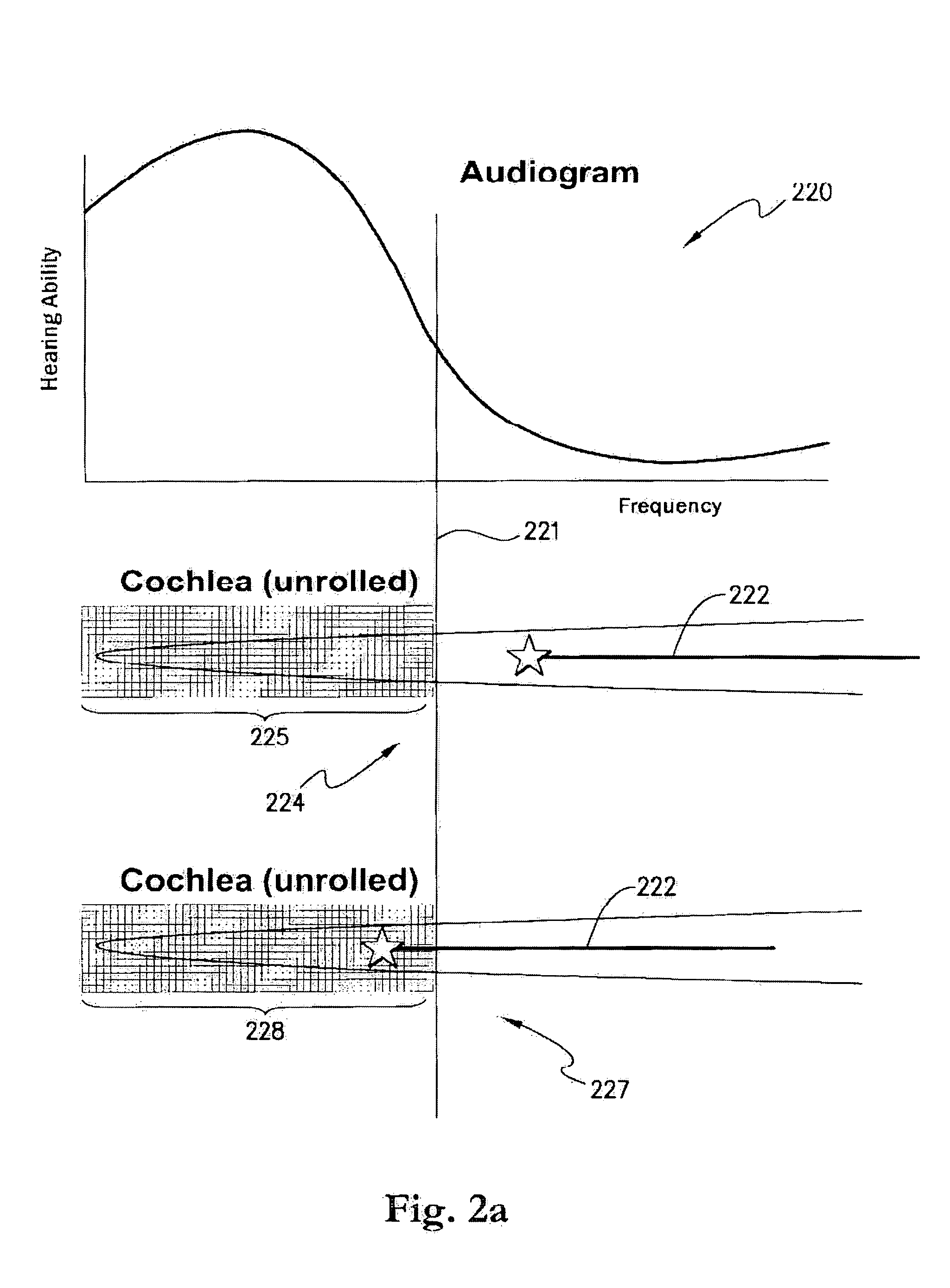 Cochlear implant fitting