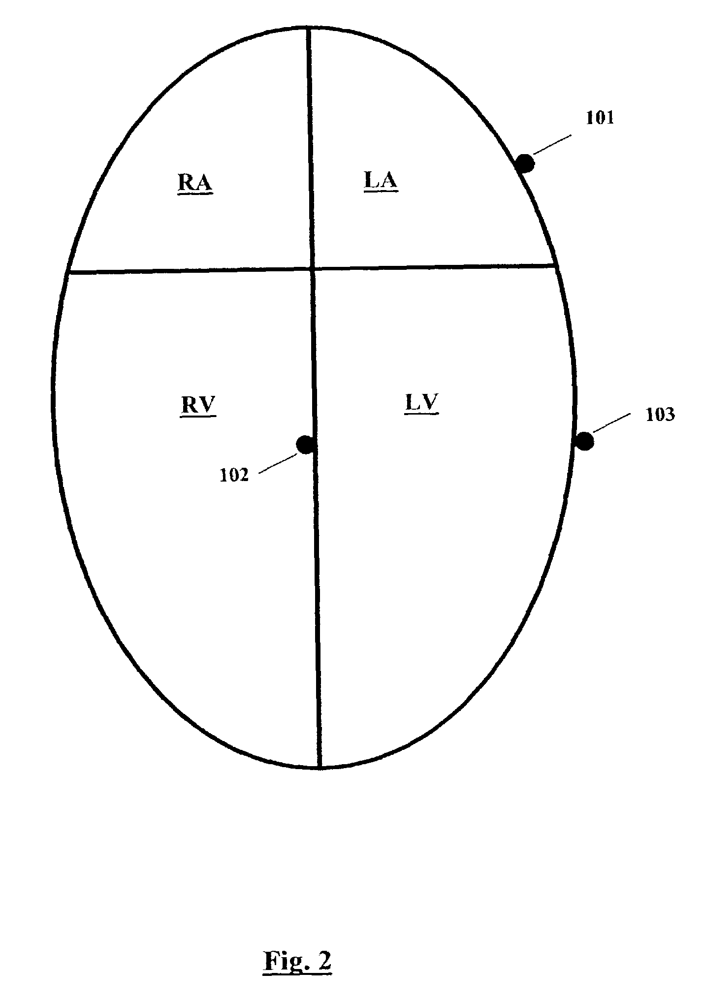 Method and apparatus for optimizing cardiac pumping performance