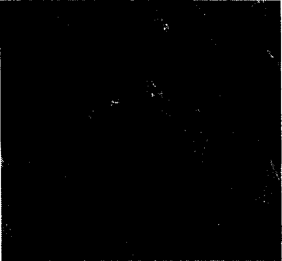 New crystalline technology of fructose-1, 6-trisodium diphosphate