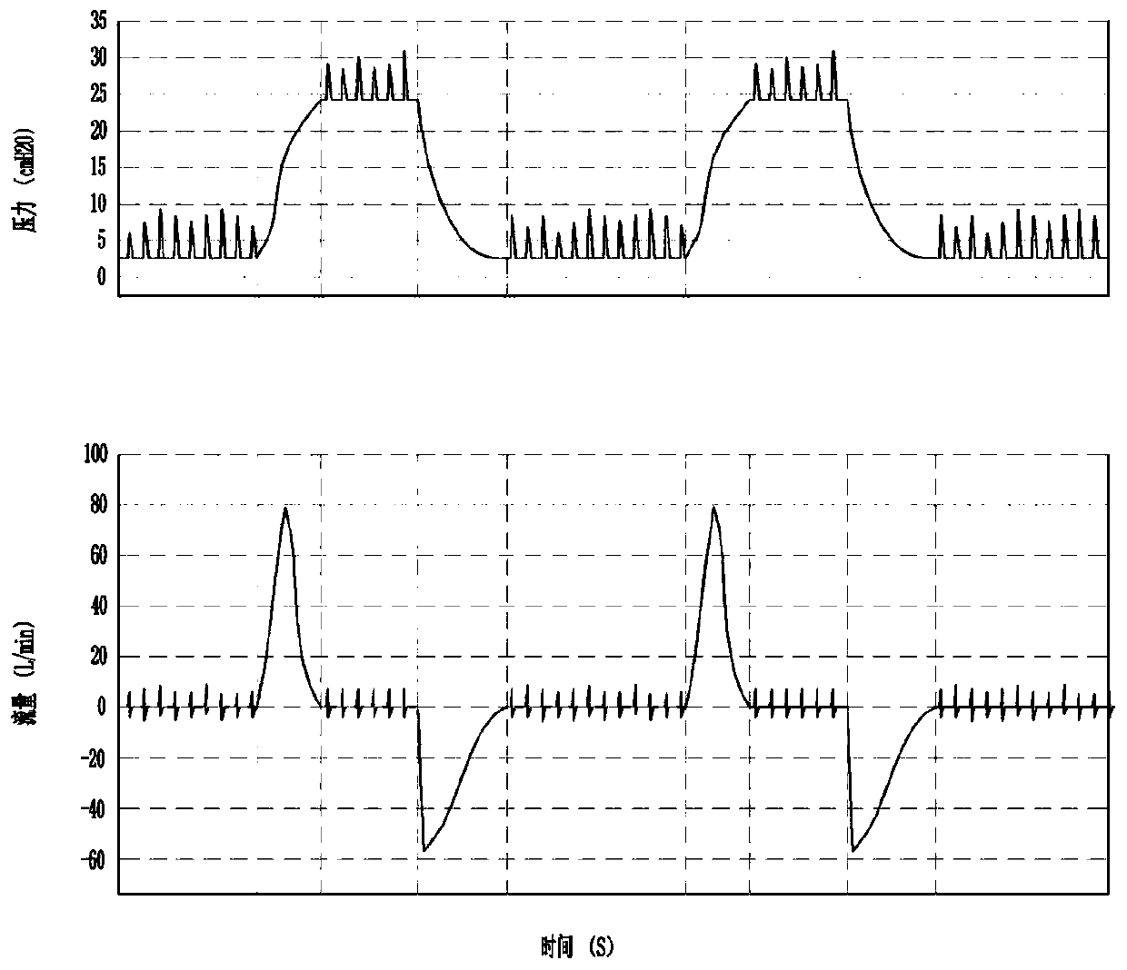 Respirator system having functions of expectoration and vibration