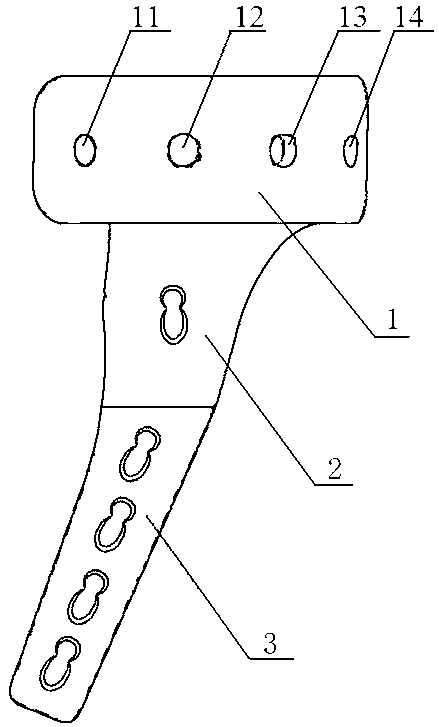 Back outer side anatomy type locking bone fracture plate for tibia plateau