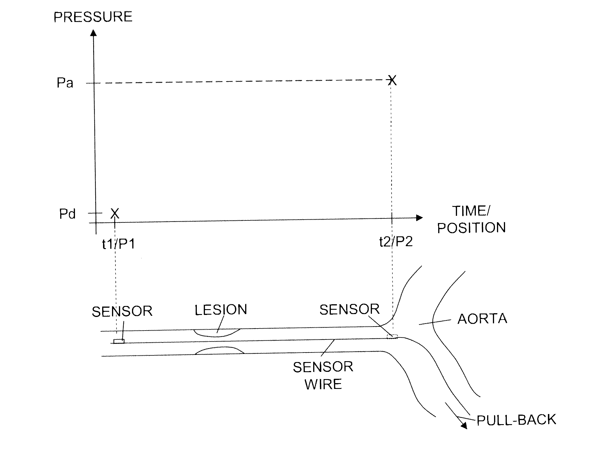 Medical system, and a method in relation to the medical system