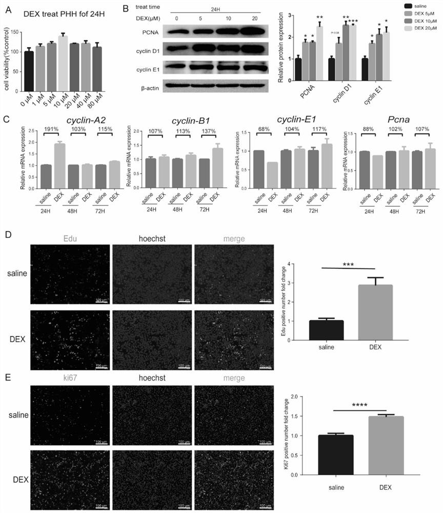 Application of dexmedetomidine in promoting liver regeneration