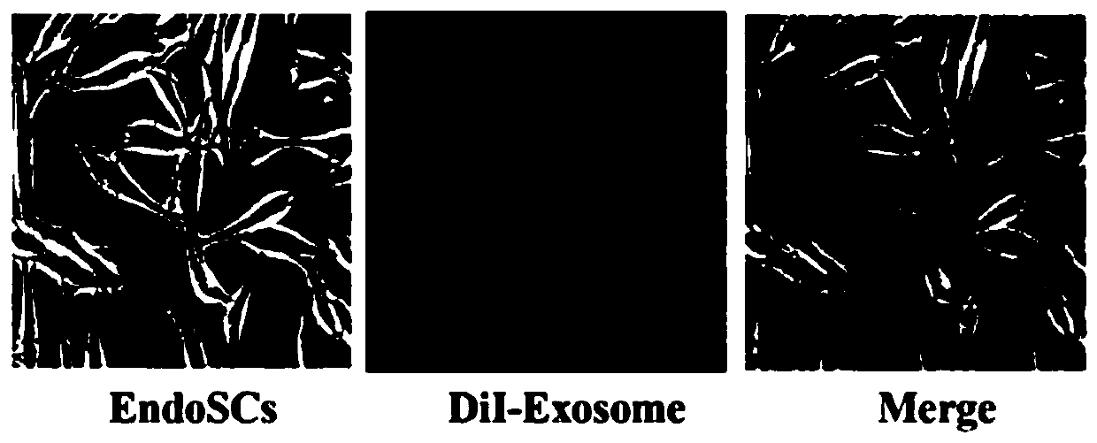 Application of exosomes derived from menstrual blood stem cells on preparation of medicament for treating intrauterine adhesion