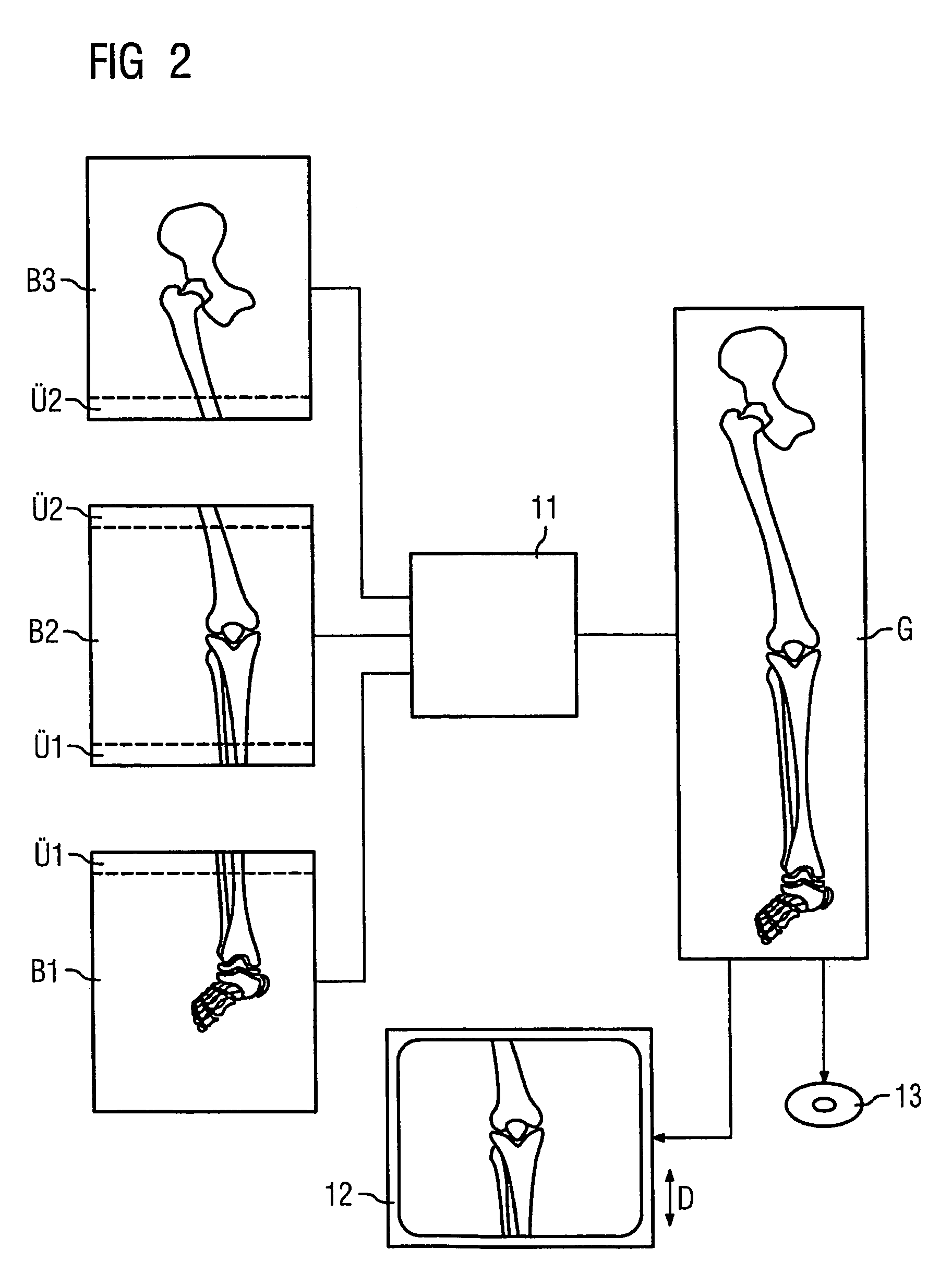 Radiation image recording device