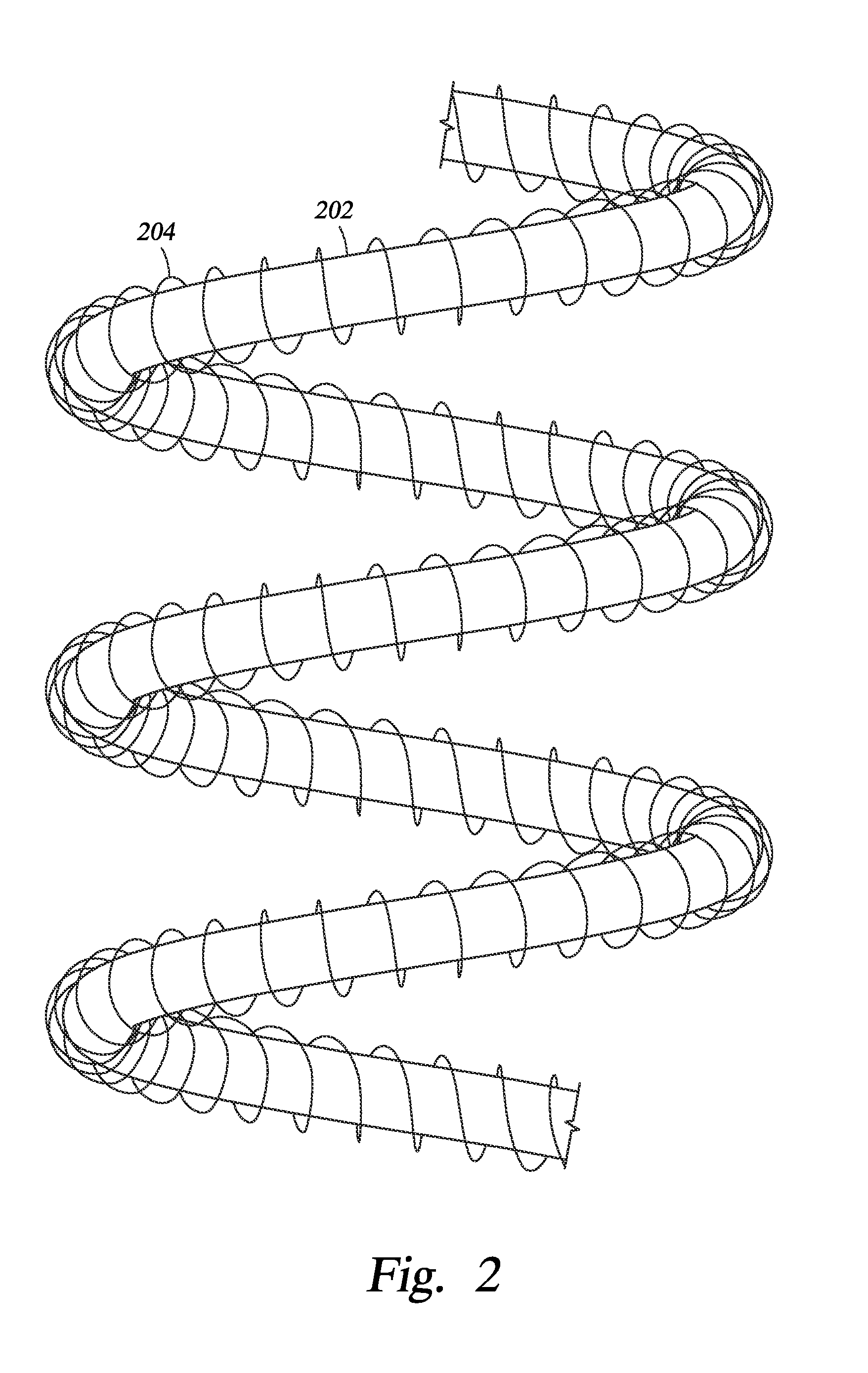 Tubular light source having overwind