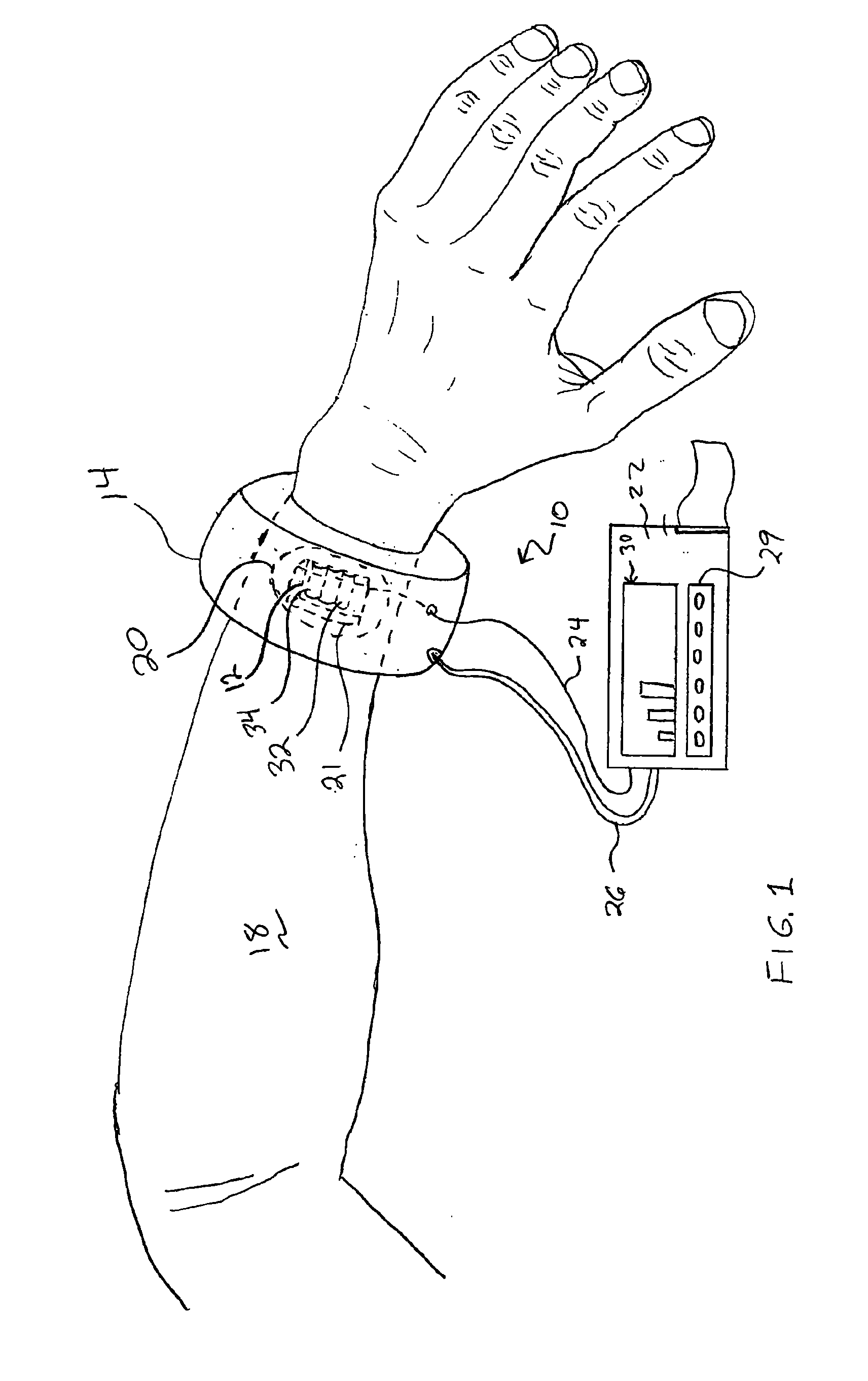 System for Automated Measurement of Skin Perfusion Pressure