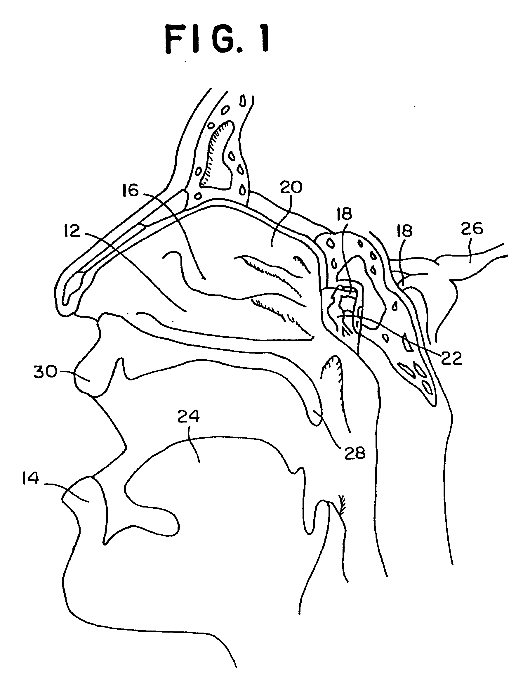 Directed intranasal administration of pharmaceutical agents