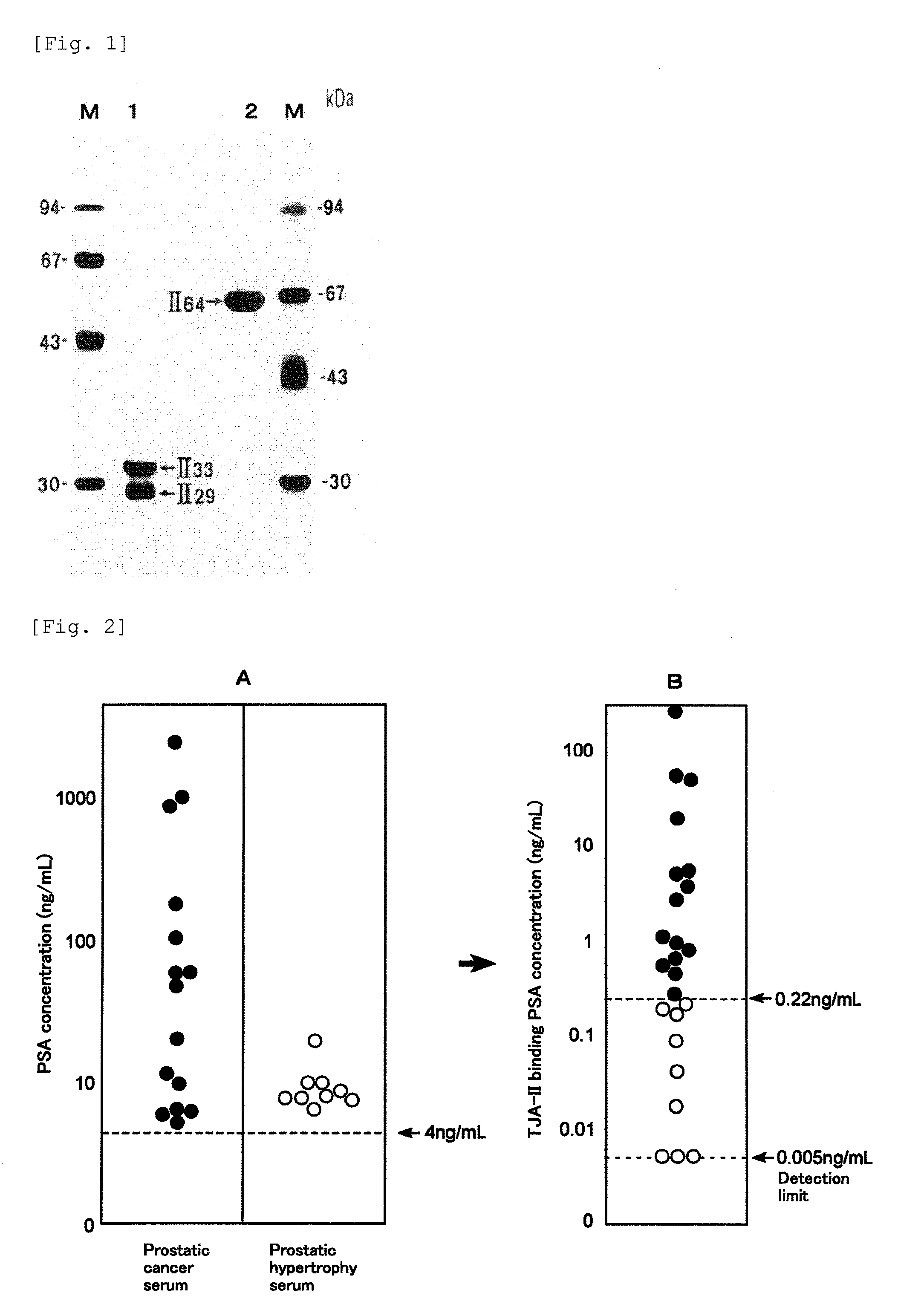 Method for analyzing psa, and a method for distinguishing prostate cancer from prostatic hypertrophy using that method for analyzing psa