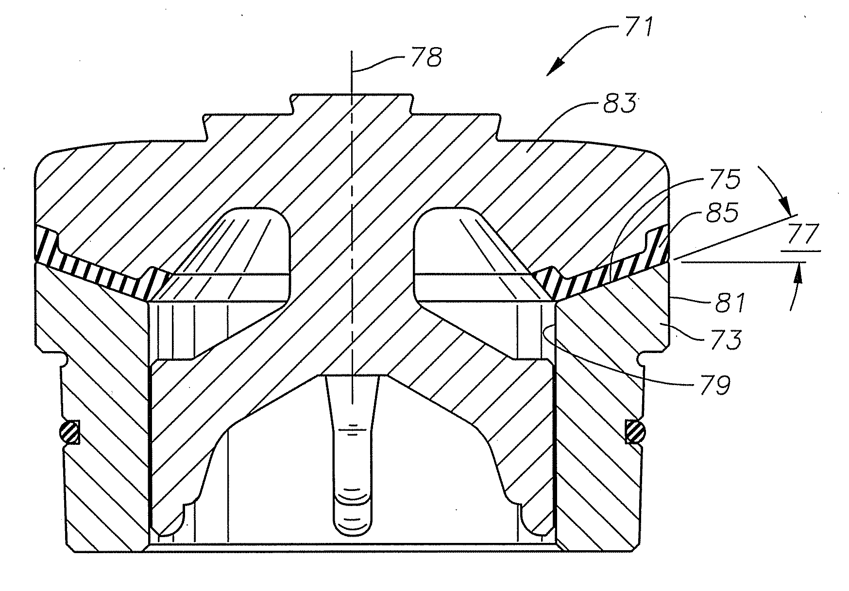 Pump Valve with Full Elastomeric Contact on Seat