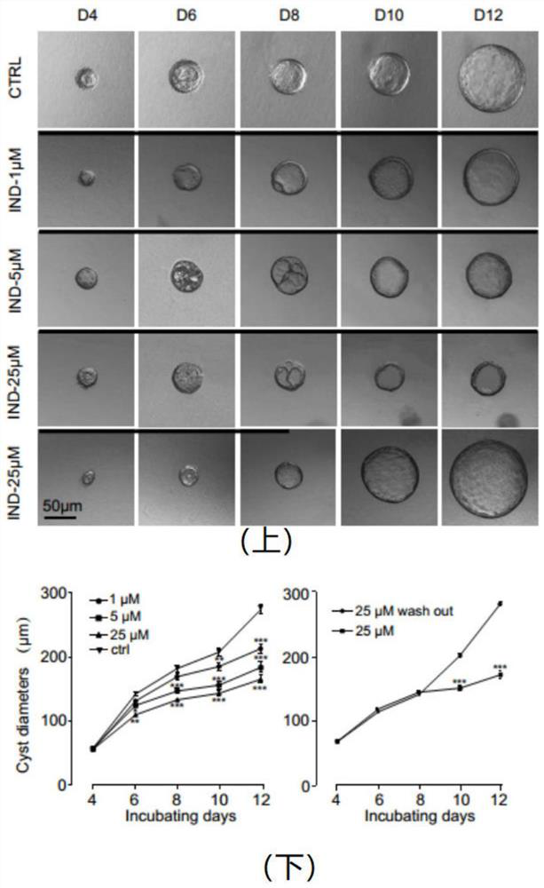 Application of 1-indanone in preparation of medicine for treating or preventing autosomal dominant polycystic kidney disease