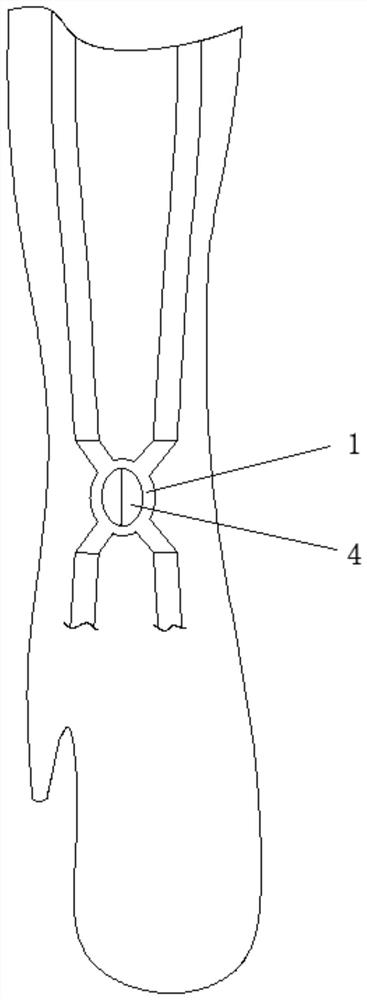 X-shaped hemodialysis port