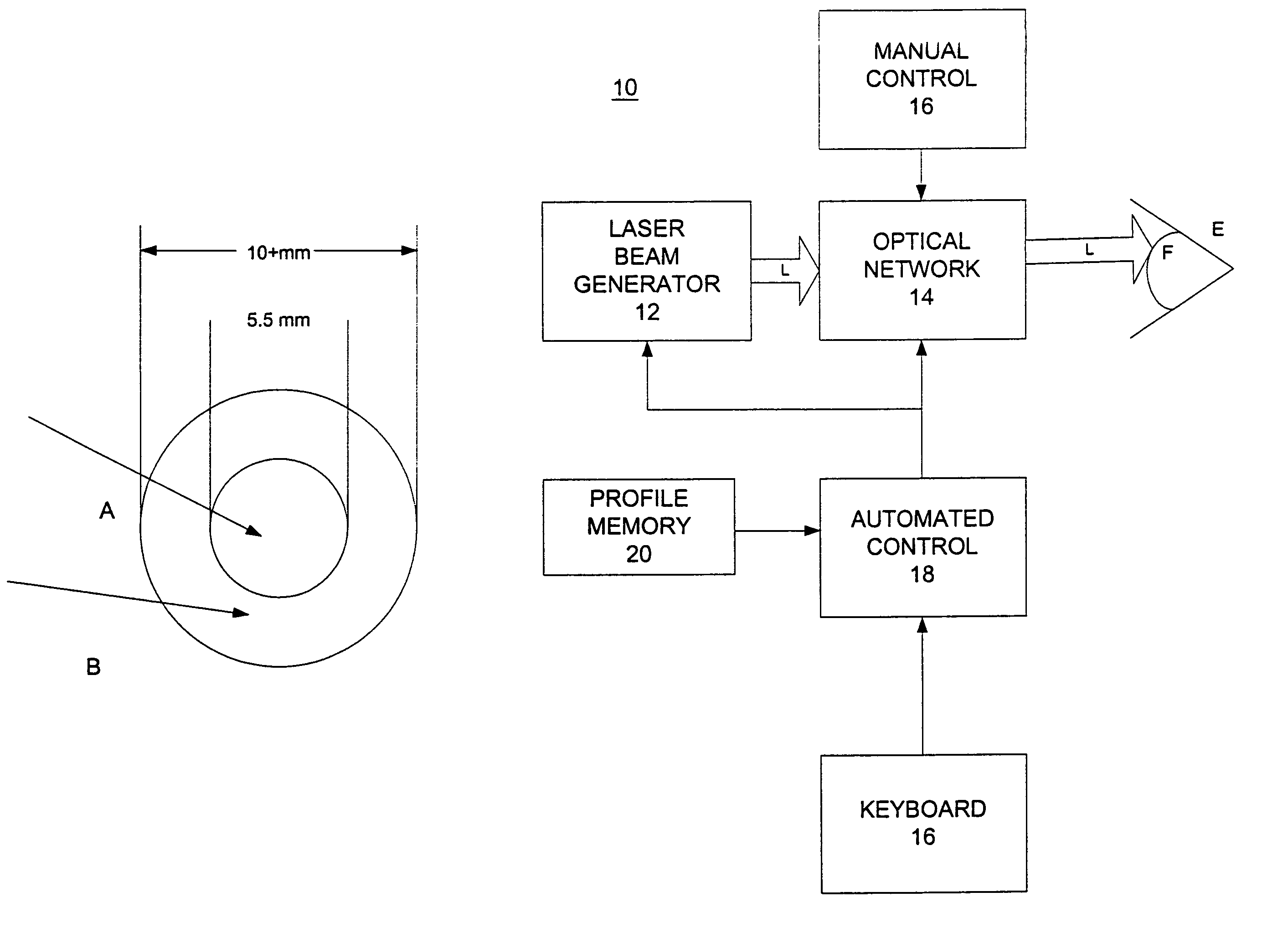 Method and apparatus for treating presbyopia