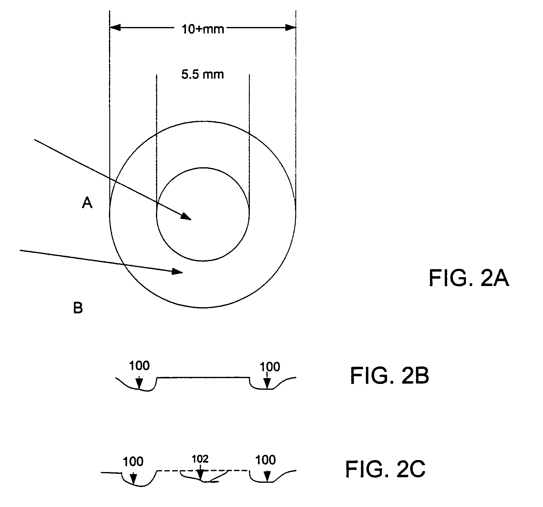 Method and apparatus for treating presbyopia