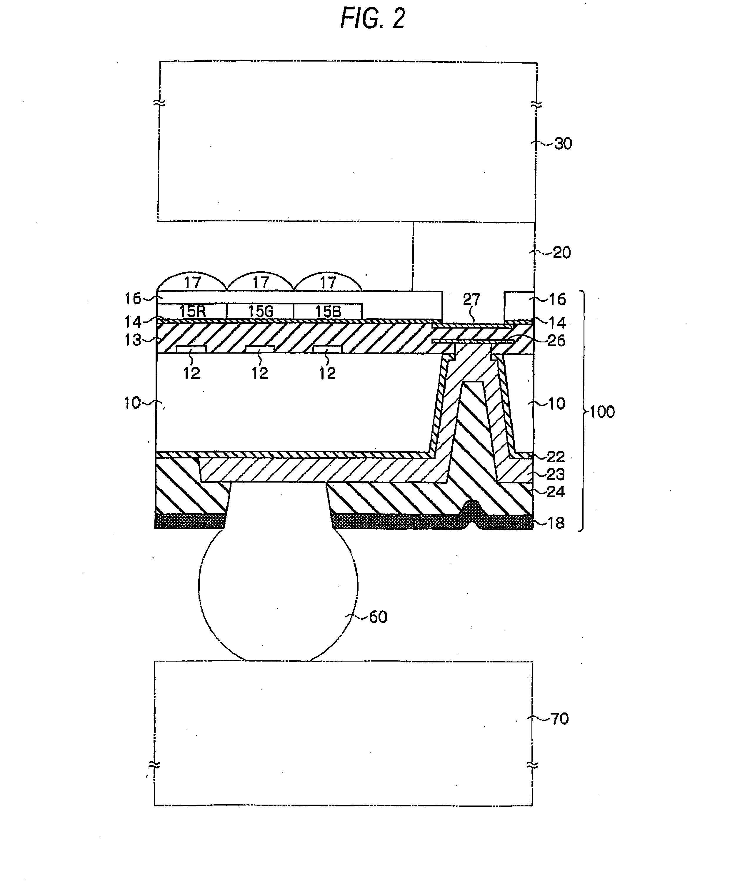 Polymerizable composition