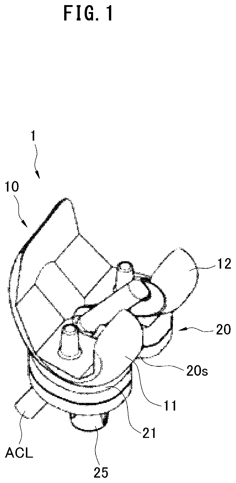 Artificial knee joint