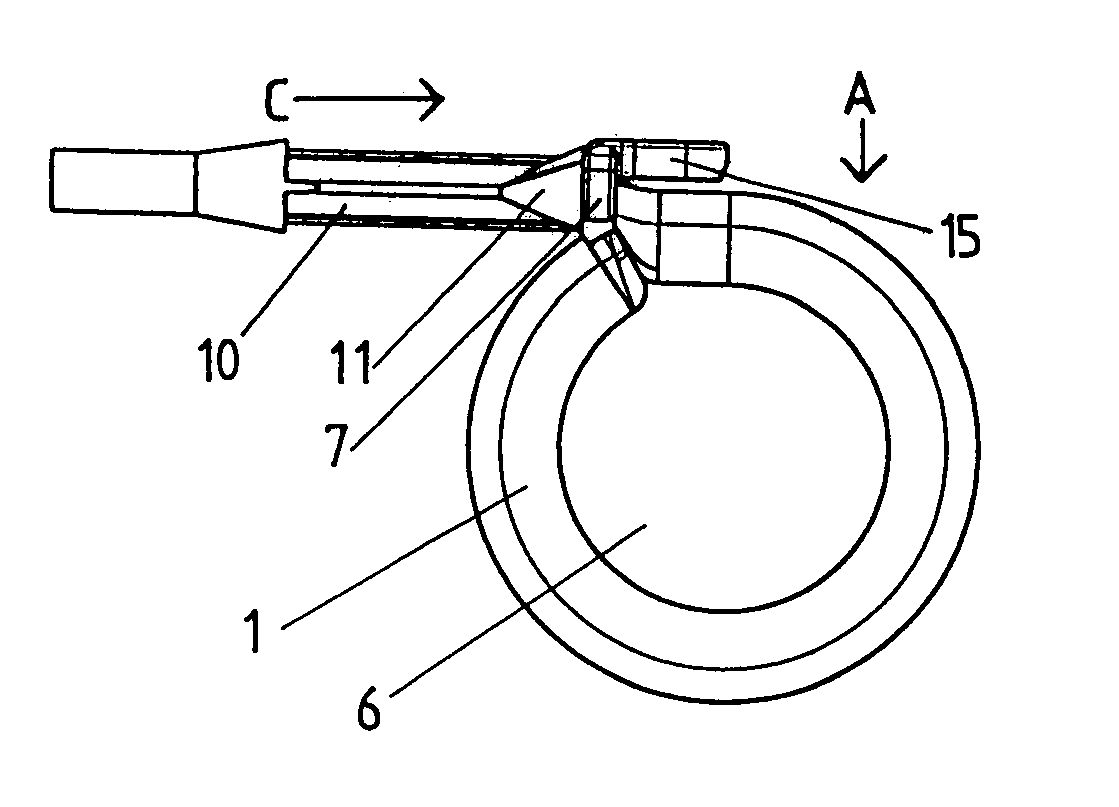 Device for generating an artificial constriction in the gastrointestinal tract