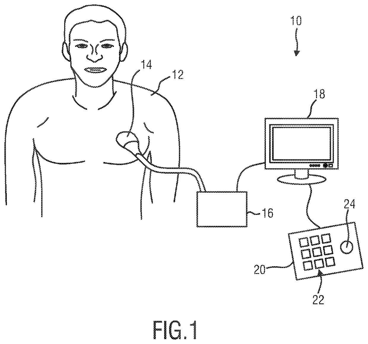 3D ultrasound imaging system