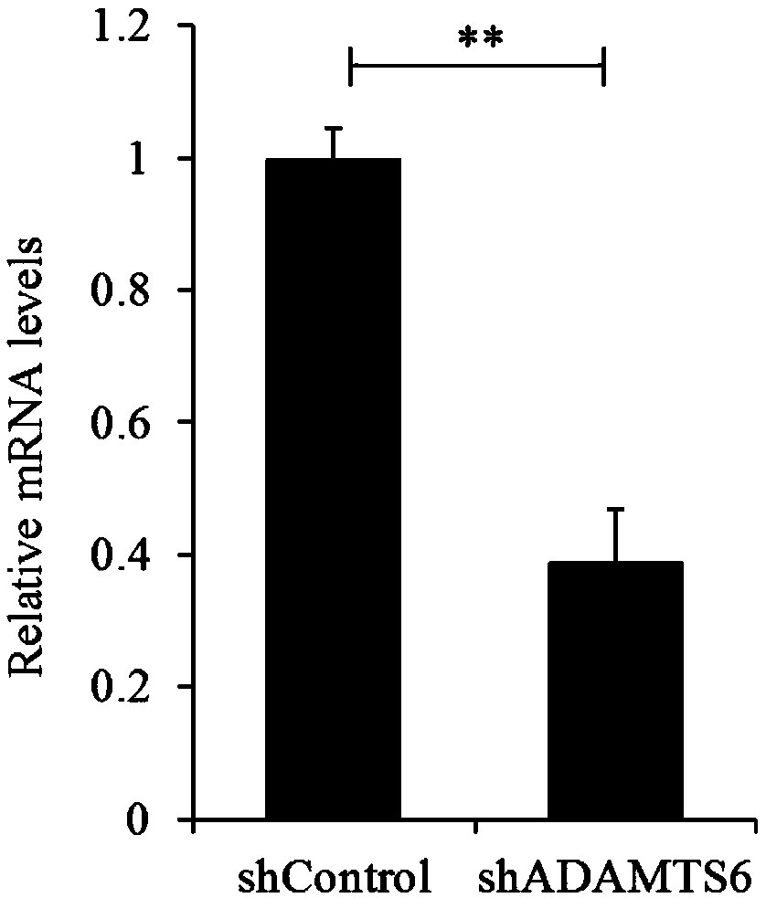 ADAMTS6 gene and shRNA sequences thereof and application in antihuman lung cancer