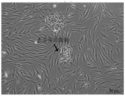 Method for constructing human dermal fibroblast in-vitro thermal damage model and application of method