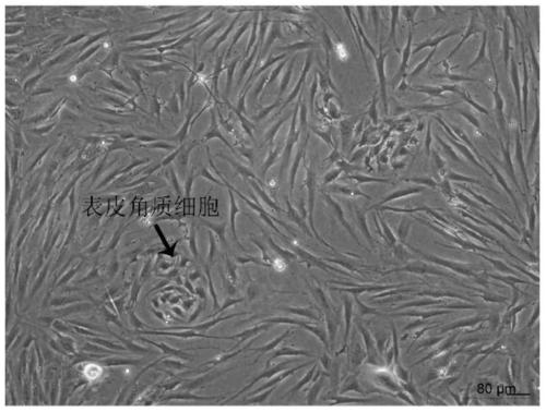 Method for constructing human dermal fibroblast in-vitro thermal damage model and application of method