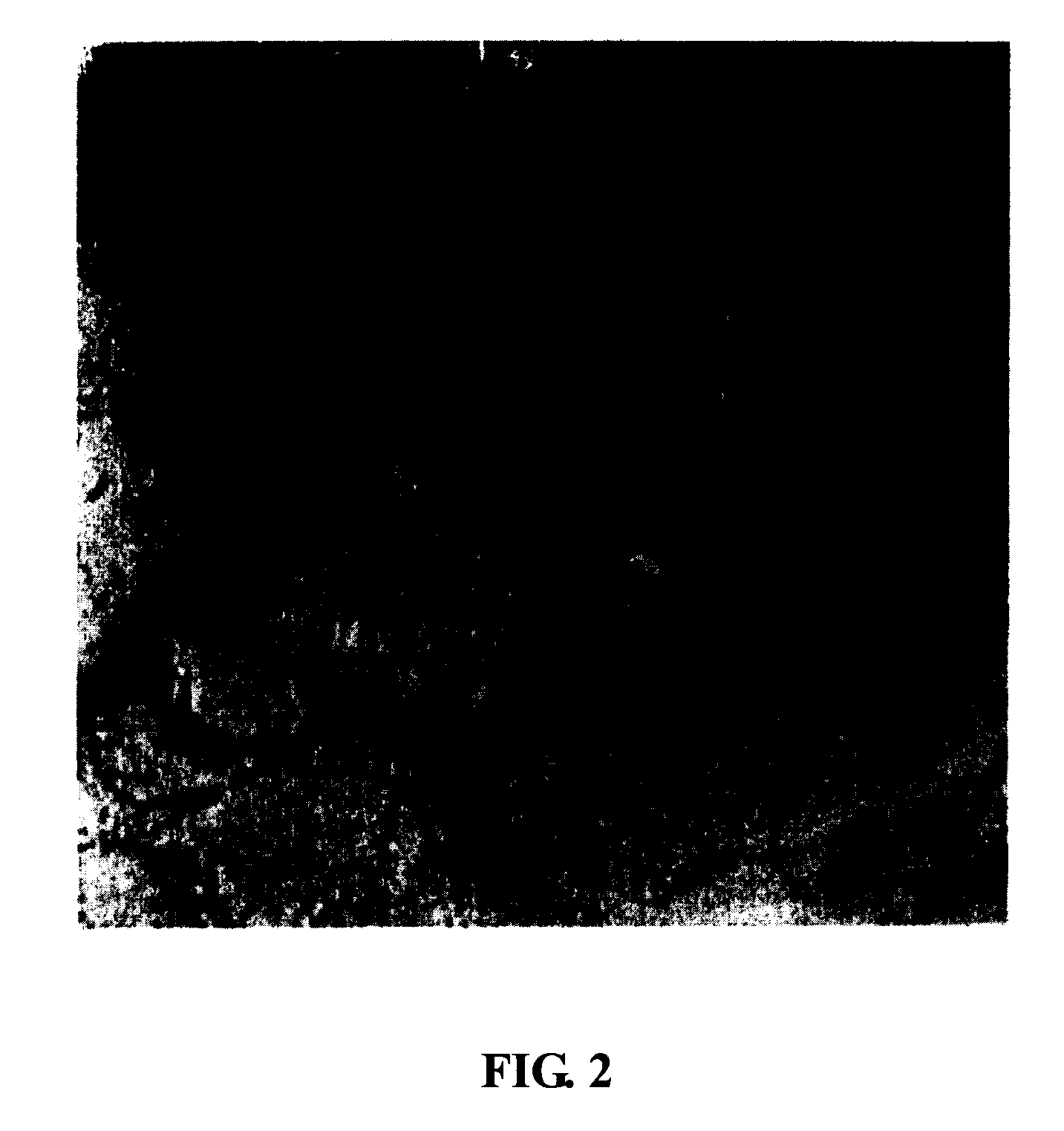 Methods for diagnosing and for monitoring the treatment of recurrent spontaneous abortion